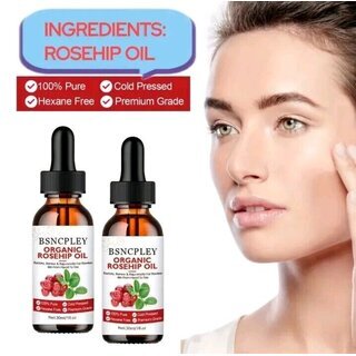 Hagebuttenl 30 ml kaltgepresstes feuchtigkeitsspendendes therisches l 